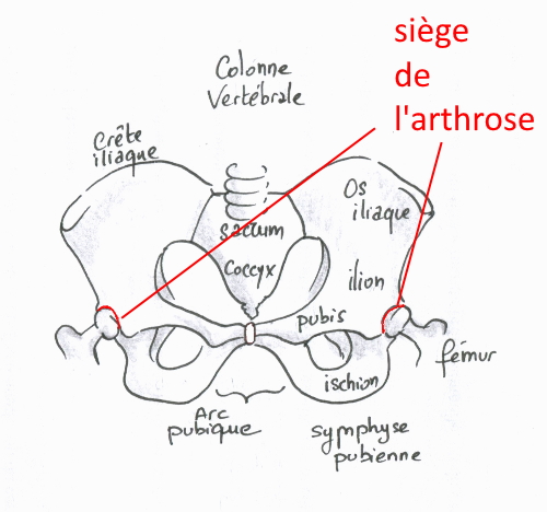 arthrose hanche cavalier